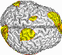 mozg-EEG