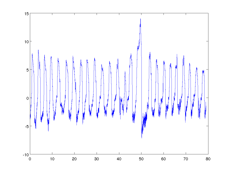 mm.fear.2.png mm.fear.2.png