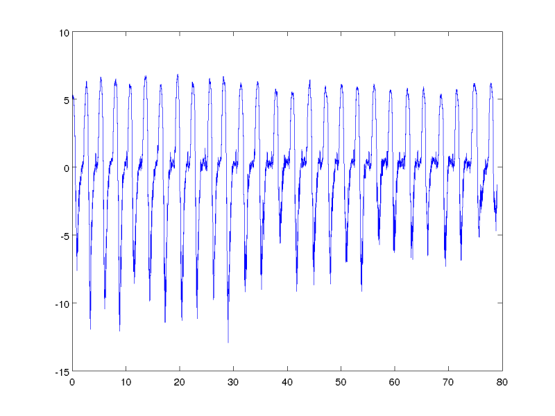 jd.neutrlal.1.png jd.neutrlal.1.png